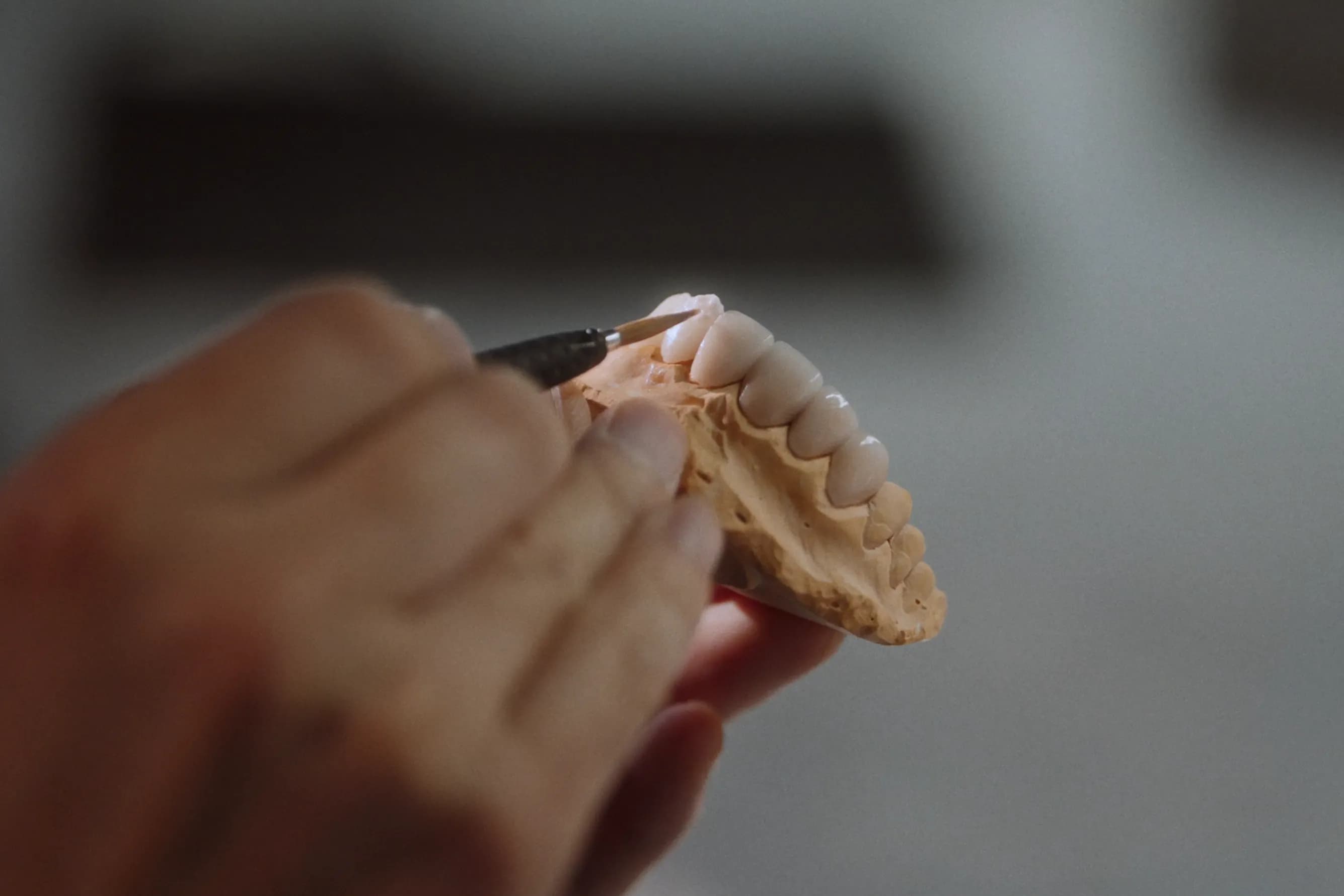 Same-day porcelain veneers being milled in Blanche in-house lab, Gangnam Seoul