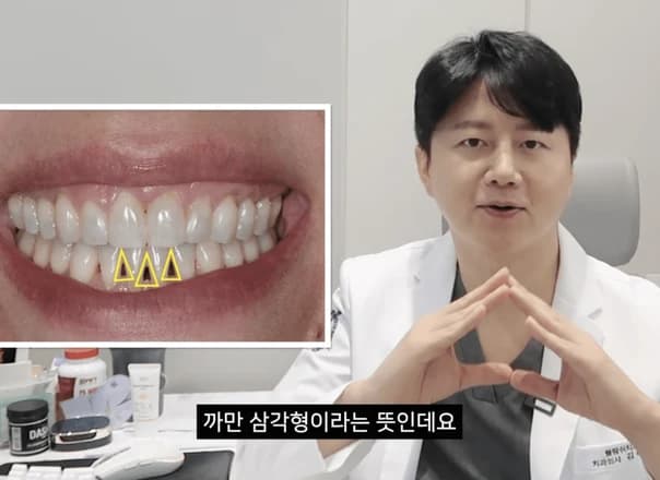 블랙 트라이앵글, 왜 생길까? 원인부터 치료, 비용, 관리까지