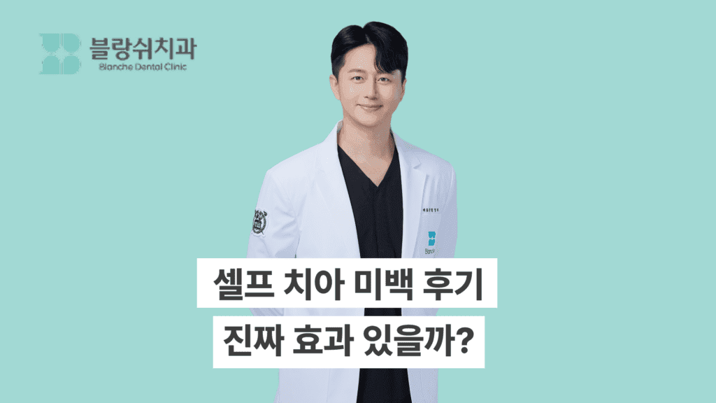 셀프 치아 미백 후기