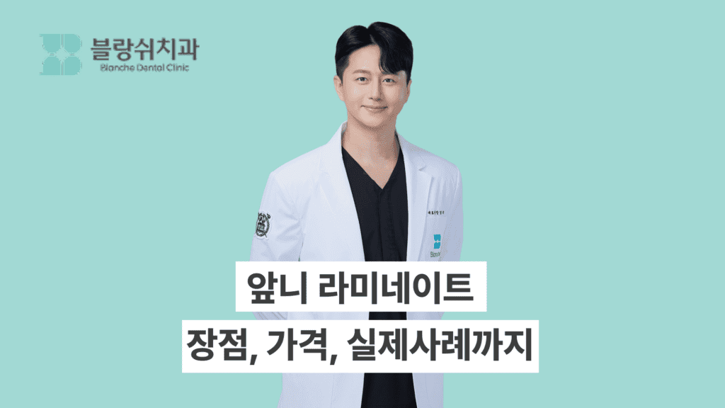 앞니 라미네이트의 모든 것