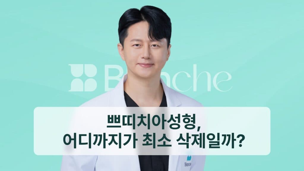쁘띠치아성형, 어디까지가 최소 삭제일까?