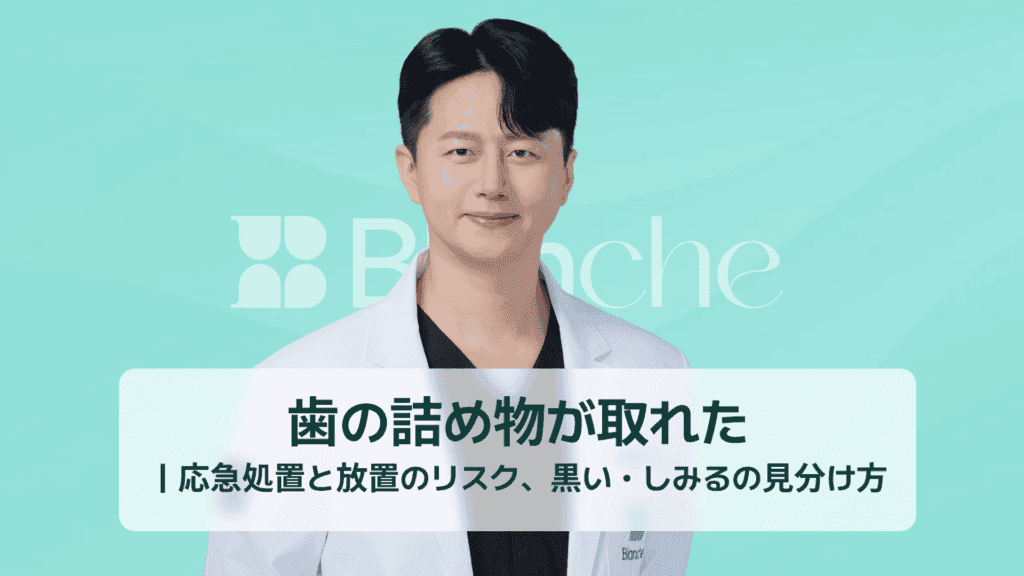 歯の詰め物が取れた｜応急処置と放置のリスク、黒い・しみるの見分け方