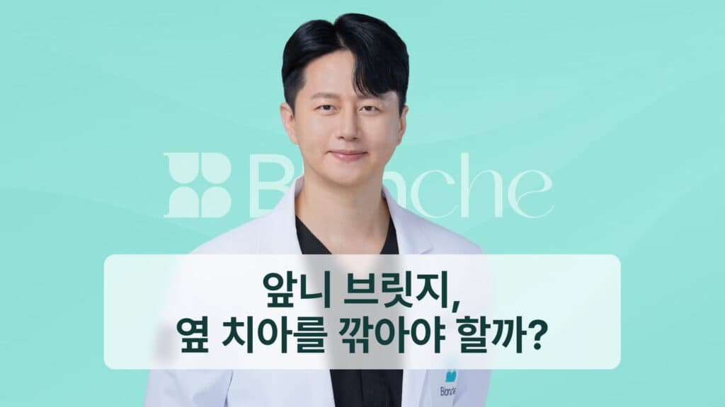 썸네일 - 앞니 브릿지, 옆 치아를 깎아야 할까?
