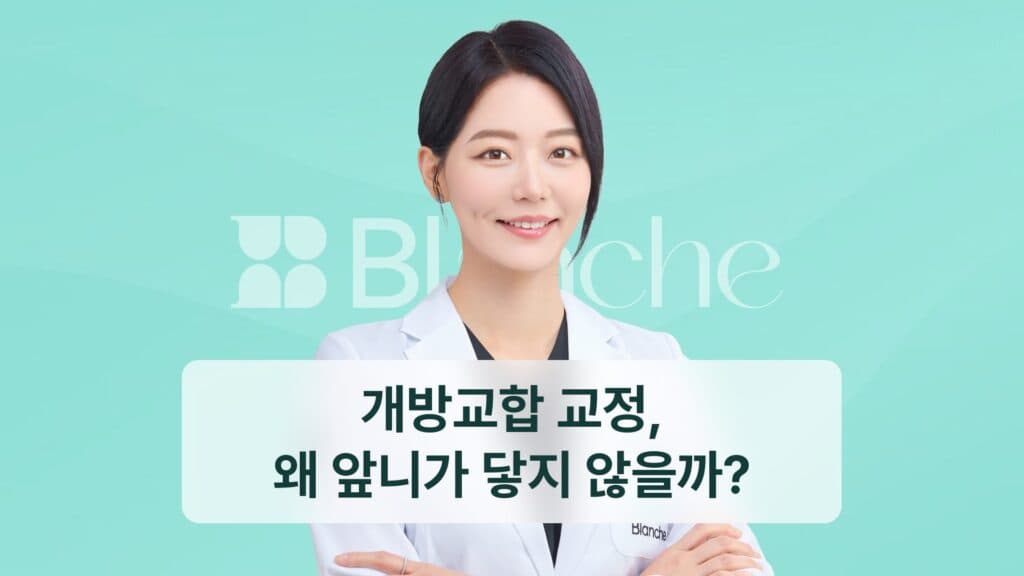 개방교합 교정, 왜 앞니가 닿지 않을까?