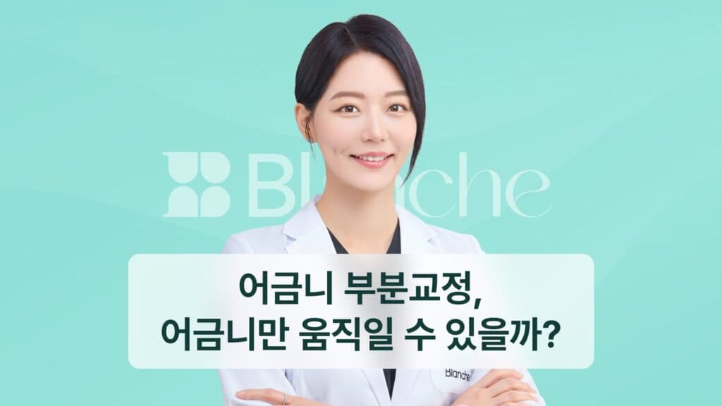 어금니 부분교정, 어금니만 움직일 수 있을까?