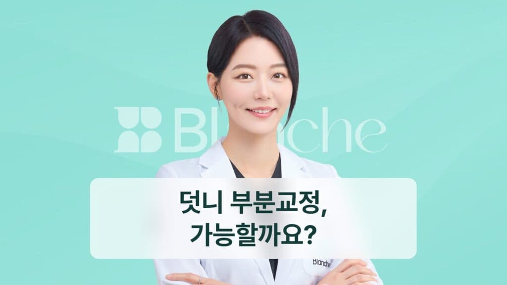 덧니 부분교정, 가능할까요?