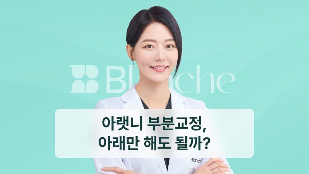 아랫니 부분교정, 아래만 해도 될까?