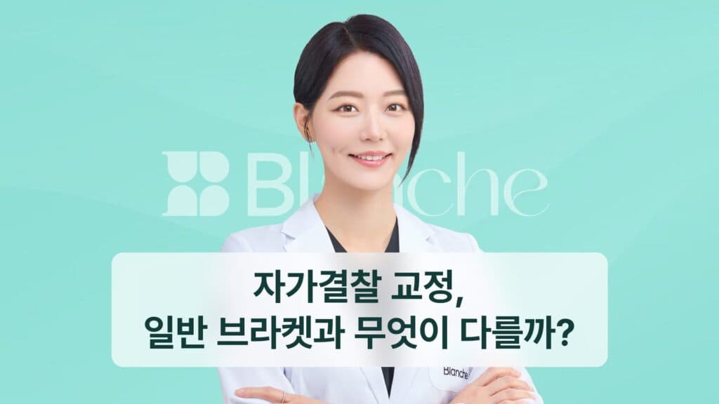 자가결찰 교정, 일반 브라켓과 무엇이 다를까?