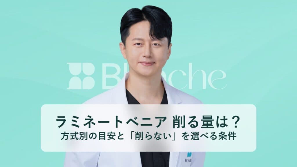ラミネートベニア 削る量は？ 方式別の目安と「削らない」を選べる条件