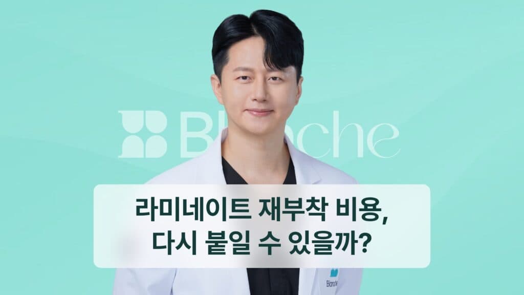 라미네이트 재부착 비용, 다시 붙일 수 있을까?