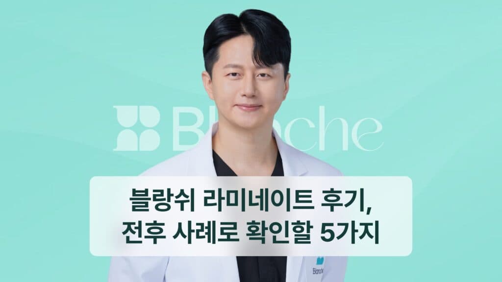 블랑쉬 라미네이트 후기, 전후 사례로 확인할 5가지