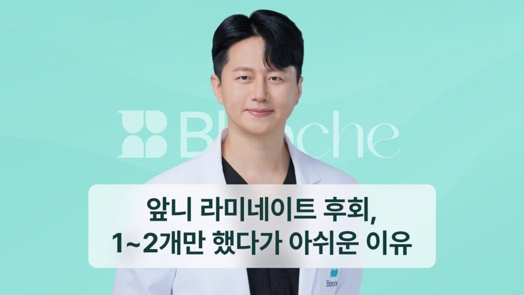 앞니 라미네이트 후회, 1~2개만 했다가 아쉬운 이유