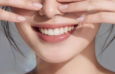 Image around the mouth where gum exposure when smiling was eased with Blanche Dental gummy smile Botox