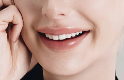 Image of lips and teeth considering smile-line balance through Blanche Dental vestibuloplasty