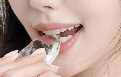 Image expressing lip volume and line through Blanche Dental lip filler