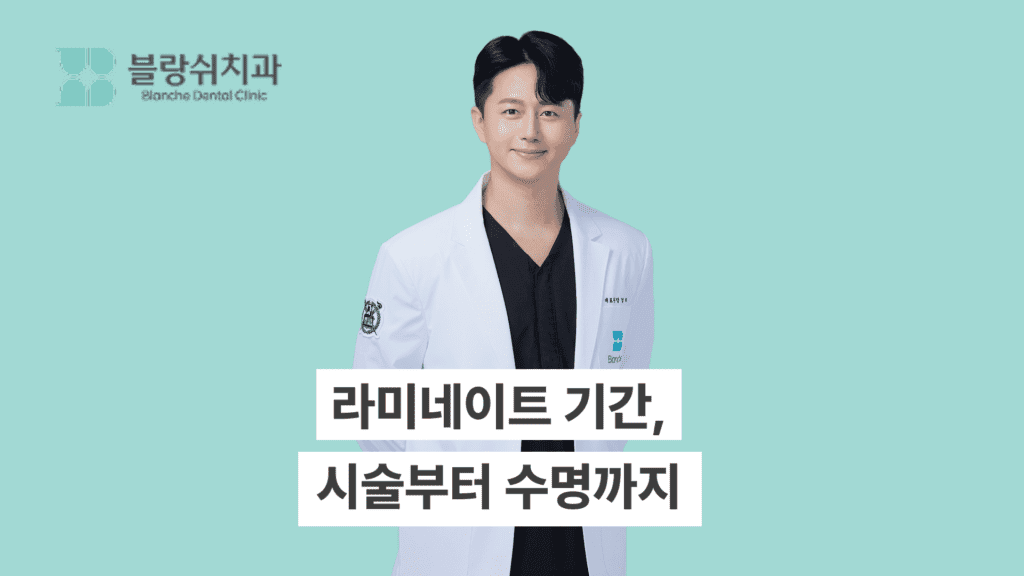 라미네이트 기간 시술부터 수명까지