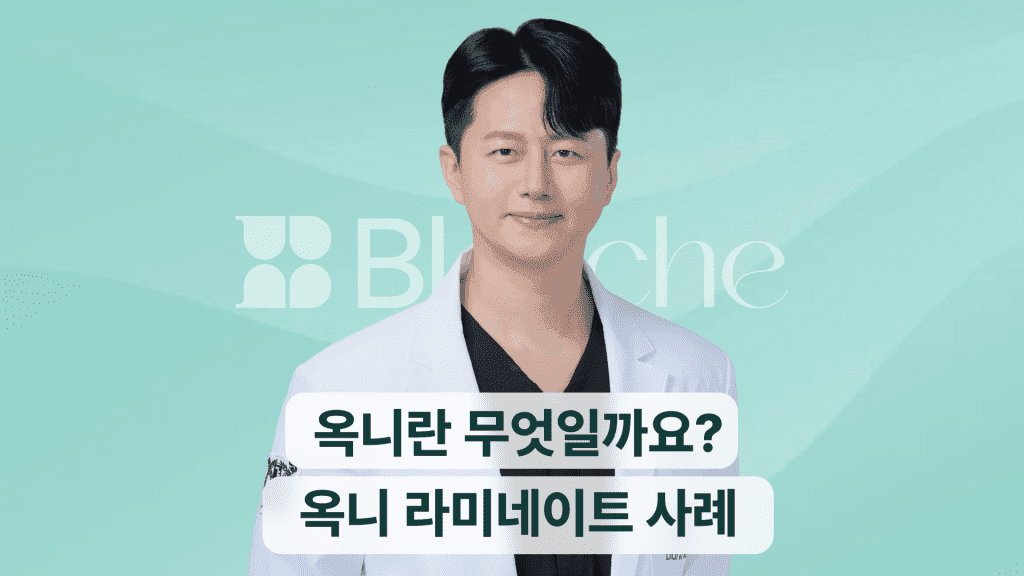 옥니란 무엇일까요? 옥니 라미네이트 사례
