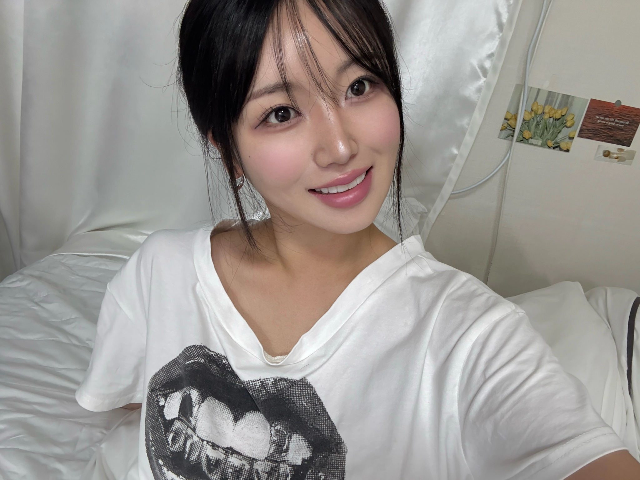 블랑쉬치과 임플란트 치료 사례 이미지