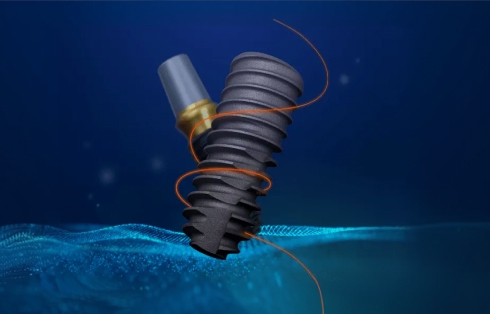 オステムインプラント画像、韓国の歯科で広く使用されている標準的なインプラントシステム