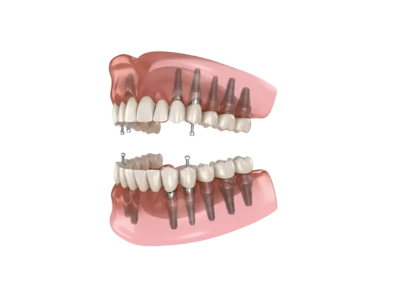 デジタルオールオン4