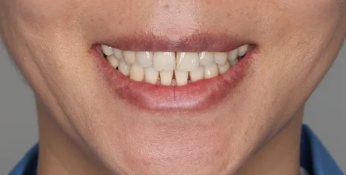 블랙트라이앵글