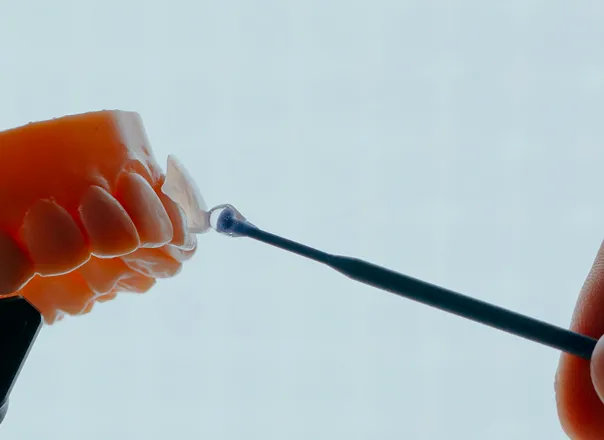 블랑쉬치과 라미네이트 선택 시 주의사항을 다룬 정보 콘텐츠 이미지