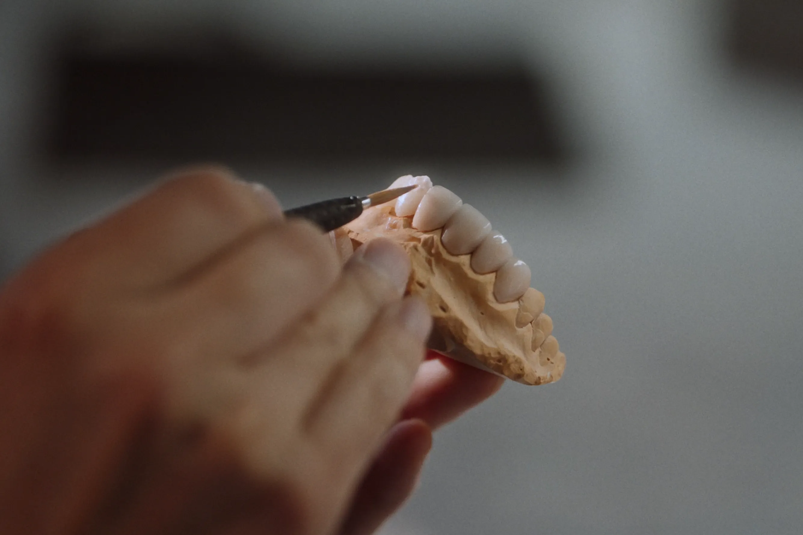 Premium One Day Veneers in Gangnam - Digital Precision 3D scanning technology