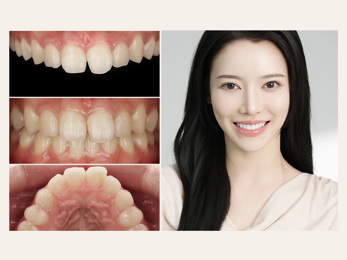 Consultation and Treatment Planning