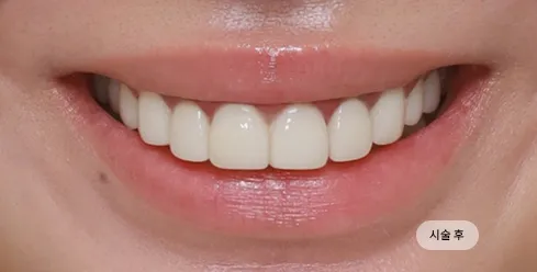 치료 후