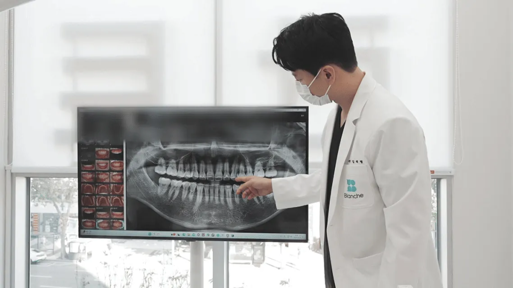 CT사진을 보며 네비게이션 임플란트에 대해 설명하는 모습