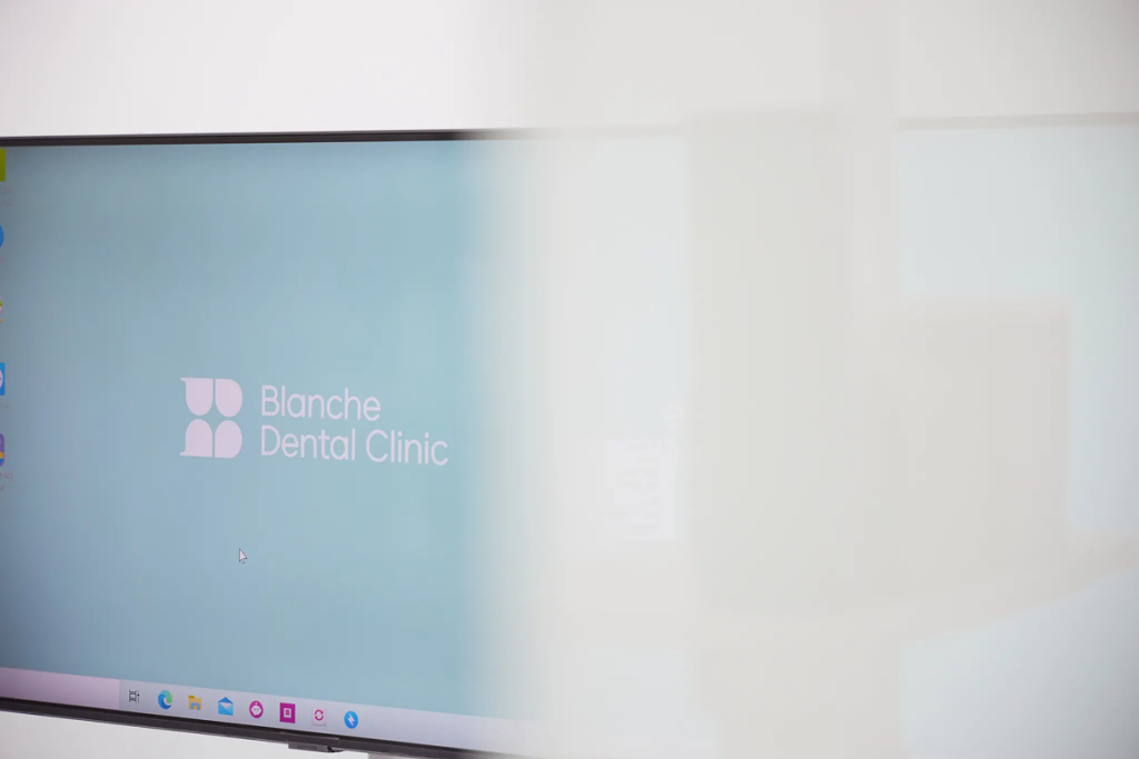 사후 관리 시스템 및 보증 여부