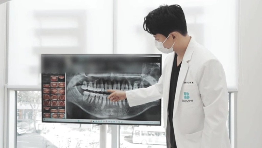 충치 범위와 치료 난이도에 따라 비용이 달라지는 이유를 설명하는 이미지