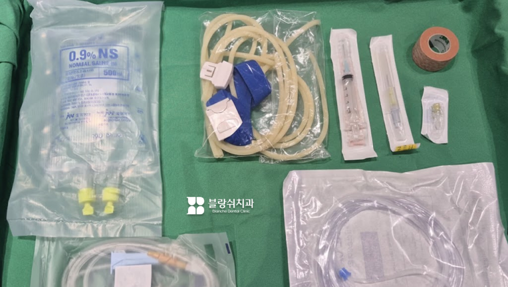 환자가 편안한 상태에서 진료받을 수 있도록 준비된 수면임플란트 전용 정맥 진정법 마취 도구와 수액 세트 구성