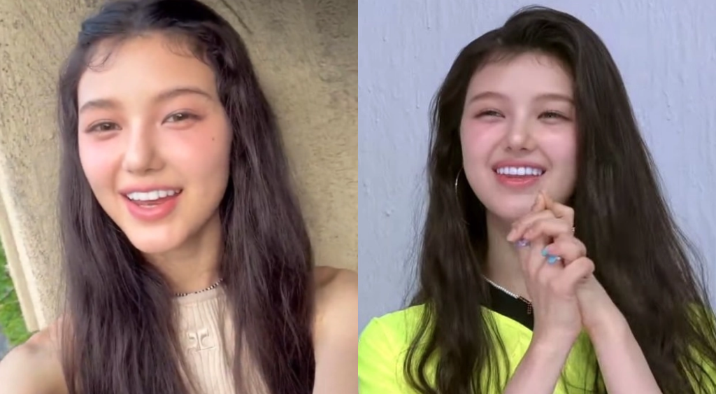 라미네이트 시술 전과 후의 치아 대칭을 비교한 에스파 카리나