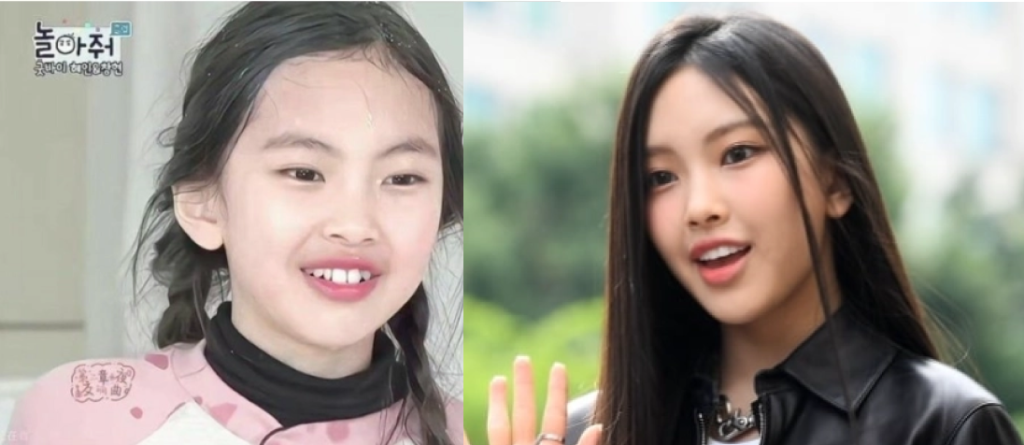 라미네이트로 완성된 고른 치아를 드러내며 웃는 뉴진스 혜인의 모습