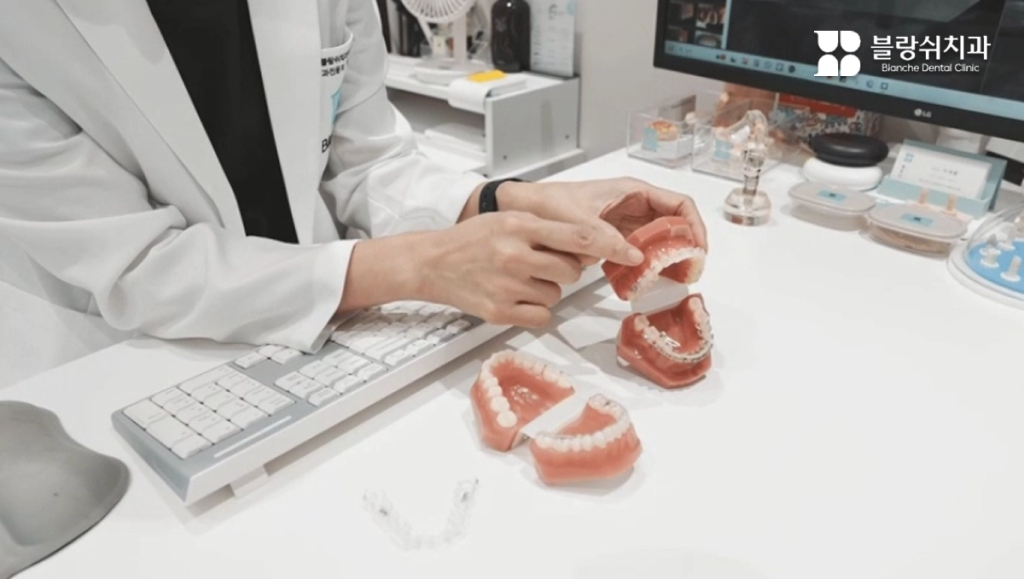 토끼이빨을 전체교정으로 치열과 돌출입 인상을 개선하는 설명 이미지