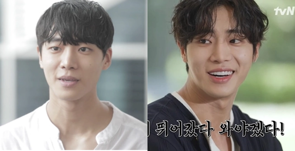 라미네이트 전후 인상이 깔끔하게 개선된 배우 추영우의 변화