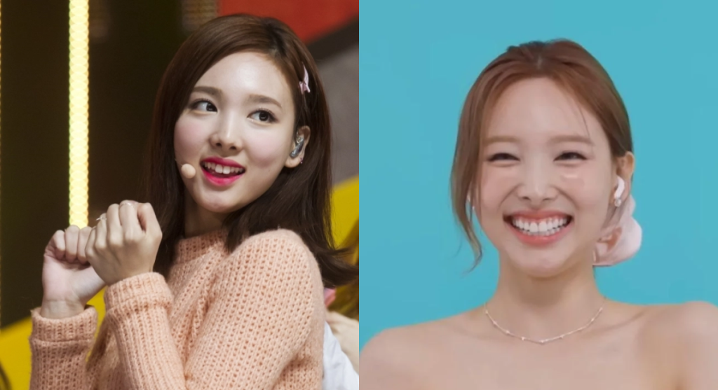 나연 라미네이트 전후사진 비교