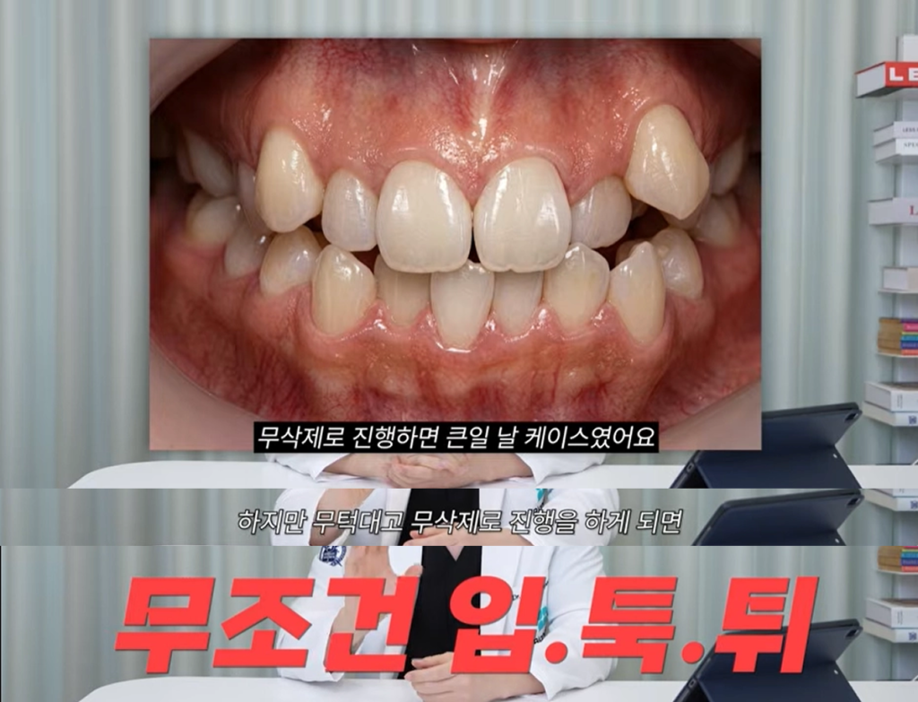 무삭제 라미네이트 진행하면 안되는 케이스