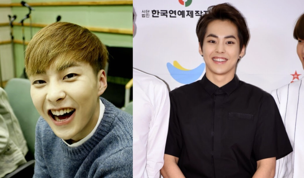 왜소치 매력을 가진 시우민(민석)이 라미네이트 후 환하게 웃는 얼굴