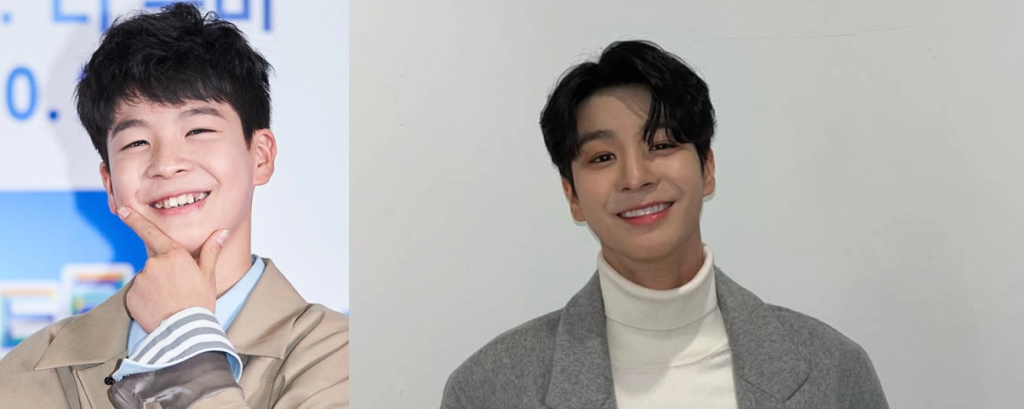 정동원 라미네이트 전후사진 비교