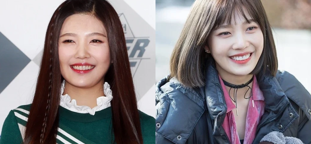 조이 라미네이트 전후사진 비교