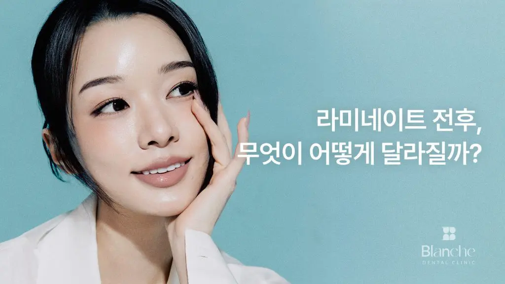 라미네이트 전후, 무엇이 어떻게 달라질까?
