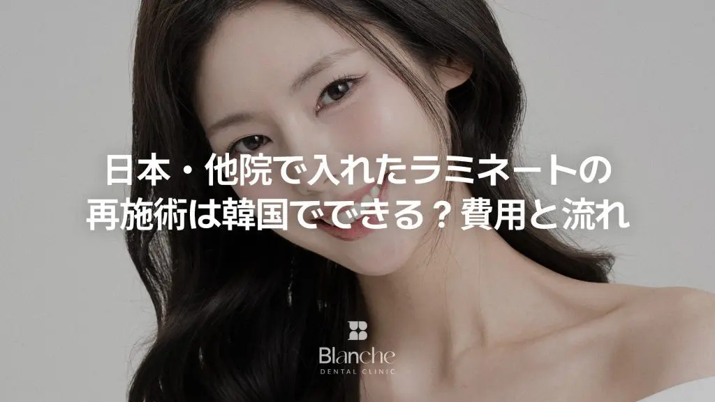 ラミネートベニアのやり直し