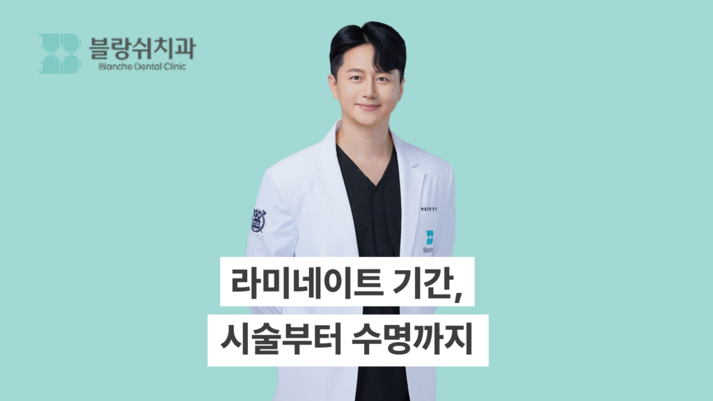 라미네이트 기간 시술부터 수명까지