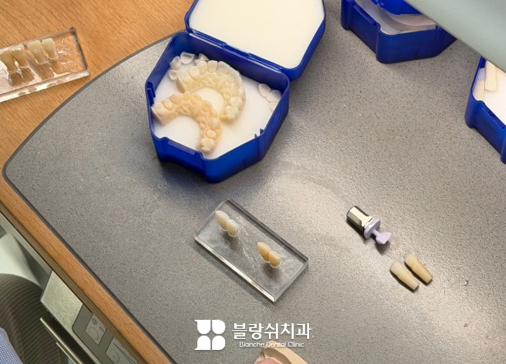 라미네이트 재료별 단가