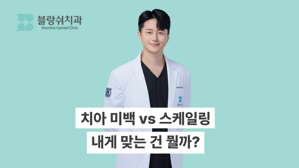 치아 미백 스케일링 차이