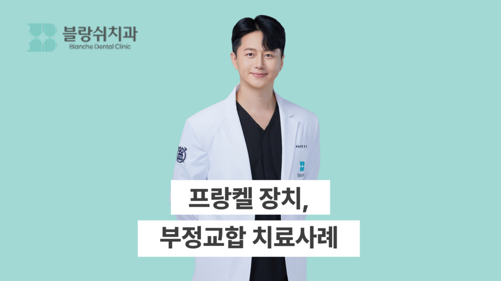 프랑켈 장치, 부정교합 치료사례