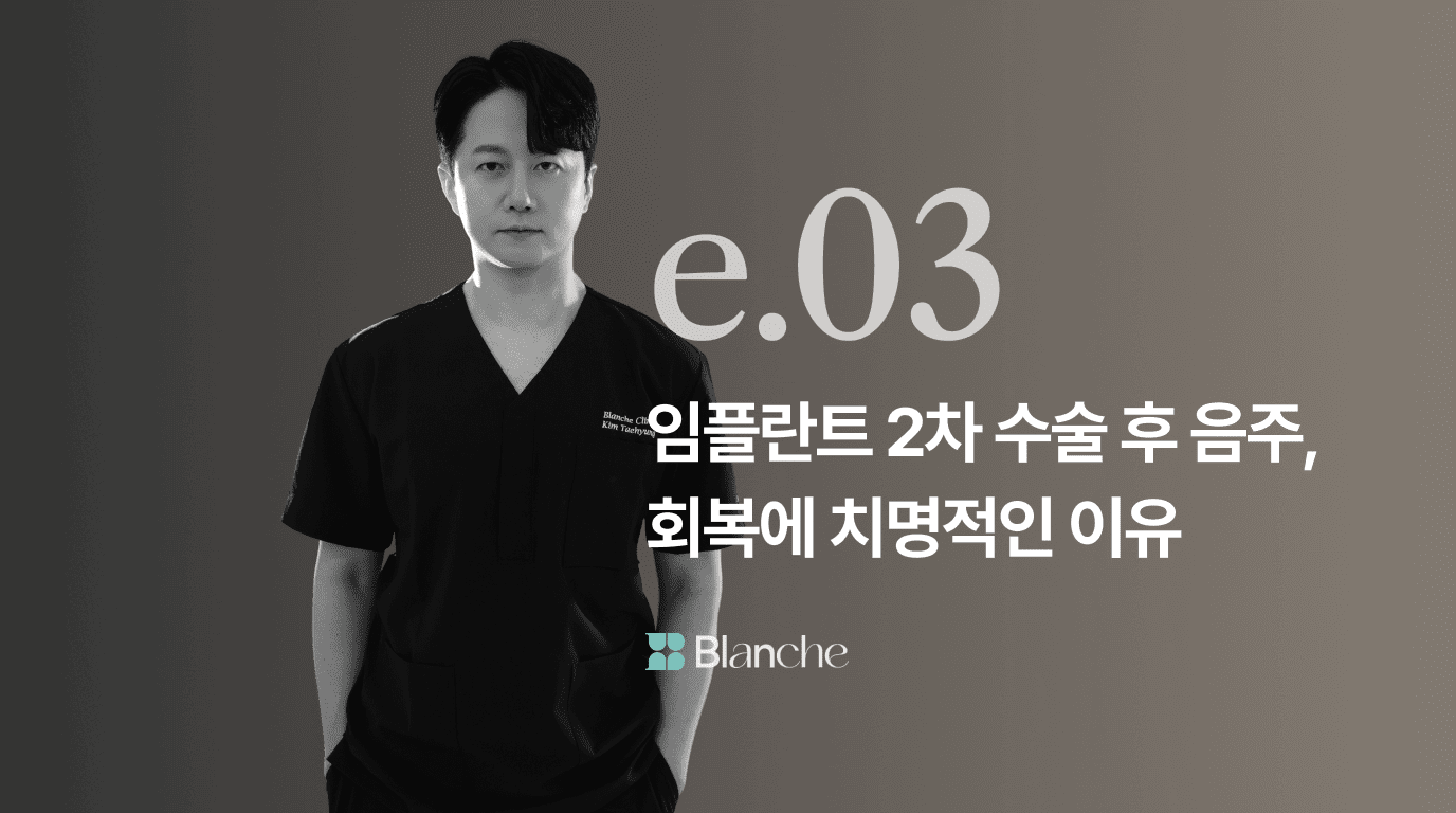 임플란트 2차 수술 후 음주, 회복에 치명적인 이유