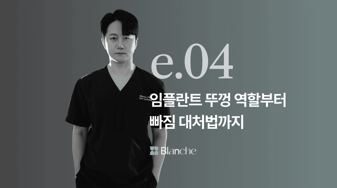 임플란트 뚜껑 역할부터 빠짐 대처법까지